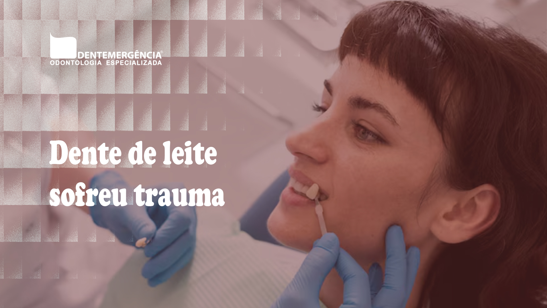 Imagem ilustrativa sobre dente de leite sofreu trauma como agir até chegar à clínica
