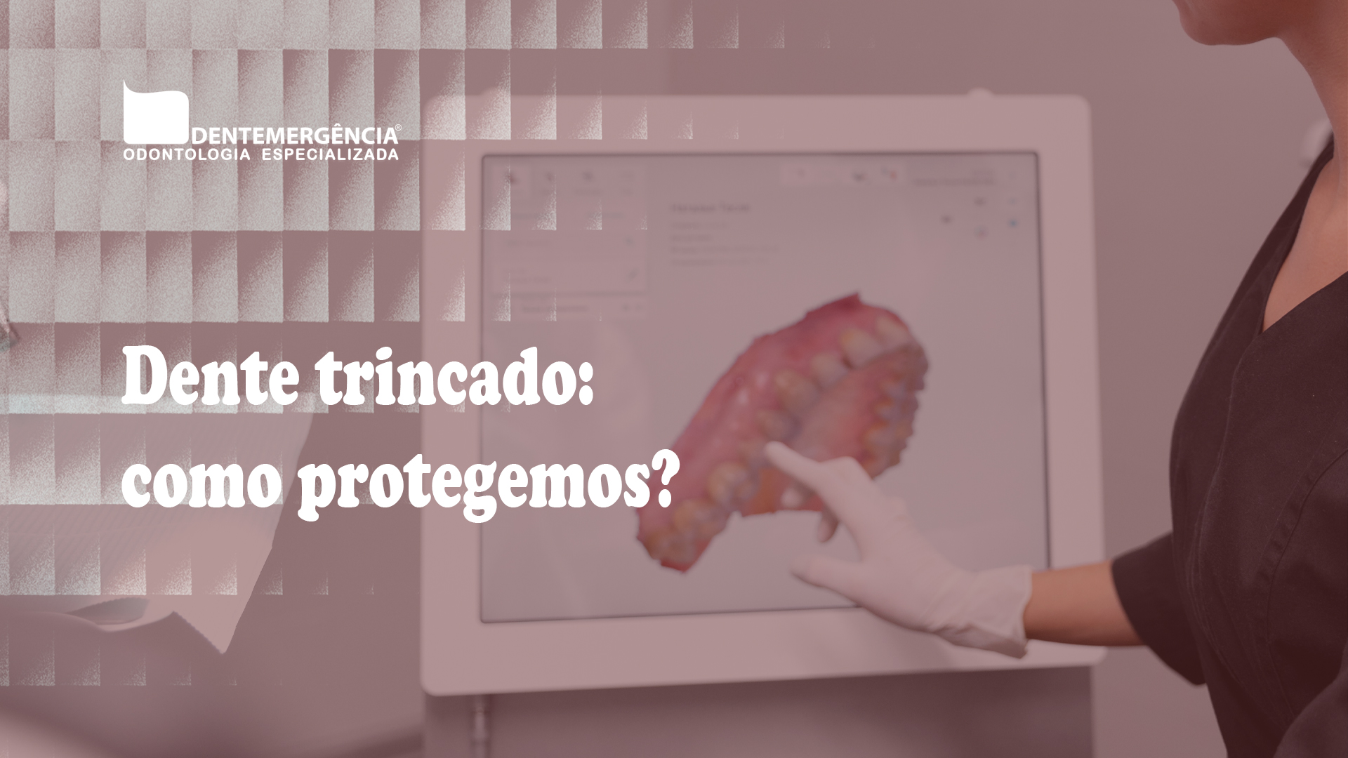Imagem de capa: Dente trincado