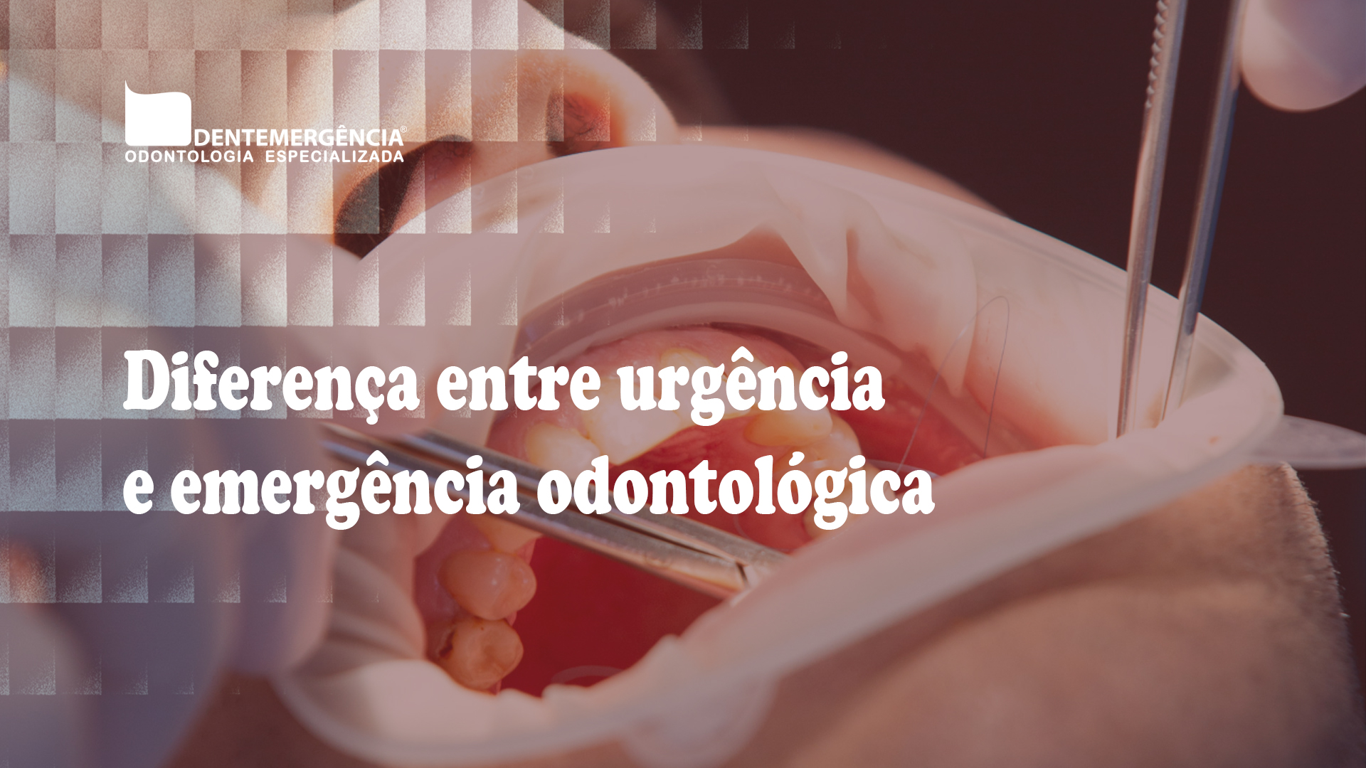 Imagem ilustrativa sobre diferença entre urgência e emergência odontológica você sabe quando ir ao dentista